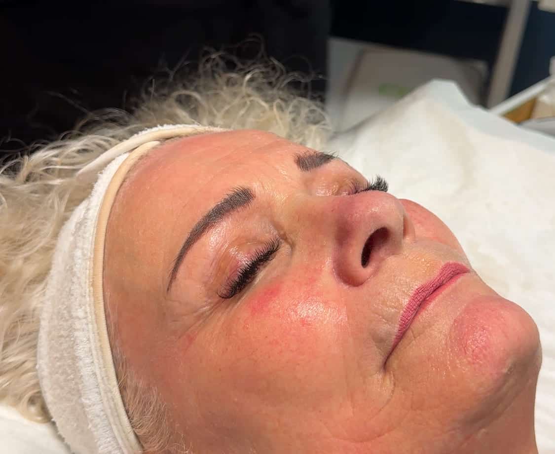 The Benefits of Microneedling & Why We Use LED Light Therapy for Best Results – IMG_2080-1